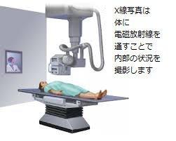 CT.png