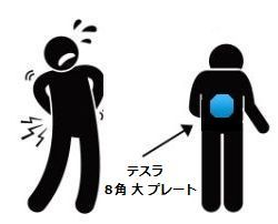 ぎっくり腰に8角.jpg