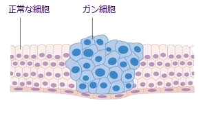 ガン細胞.png