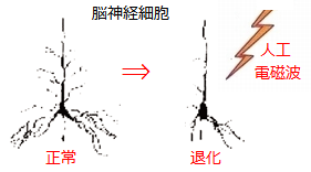 ニューロン退化.png