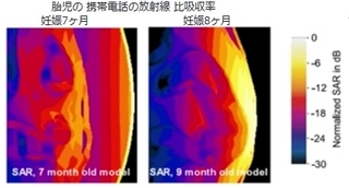 携帯電話妊婦.jpg