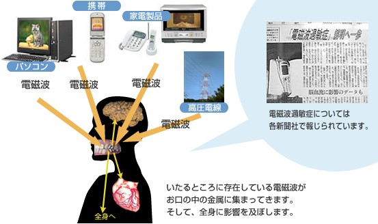 歯の金属.jpg