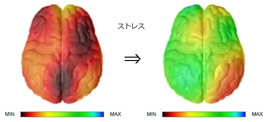 脳の活性化.jpg
