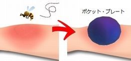 虫に刺されたら、テスラ ポケットプレートを