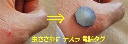 虫刺されにも、テスラ 電話タグ