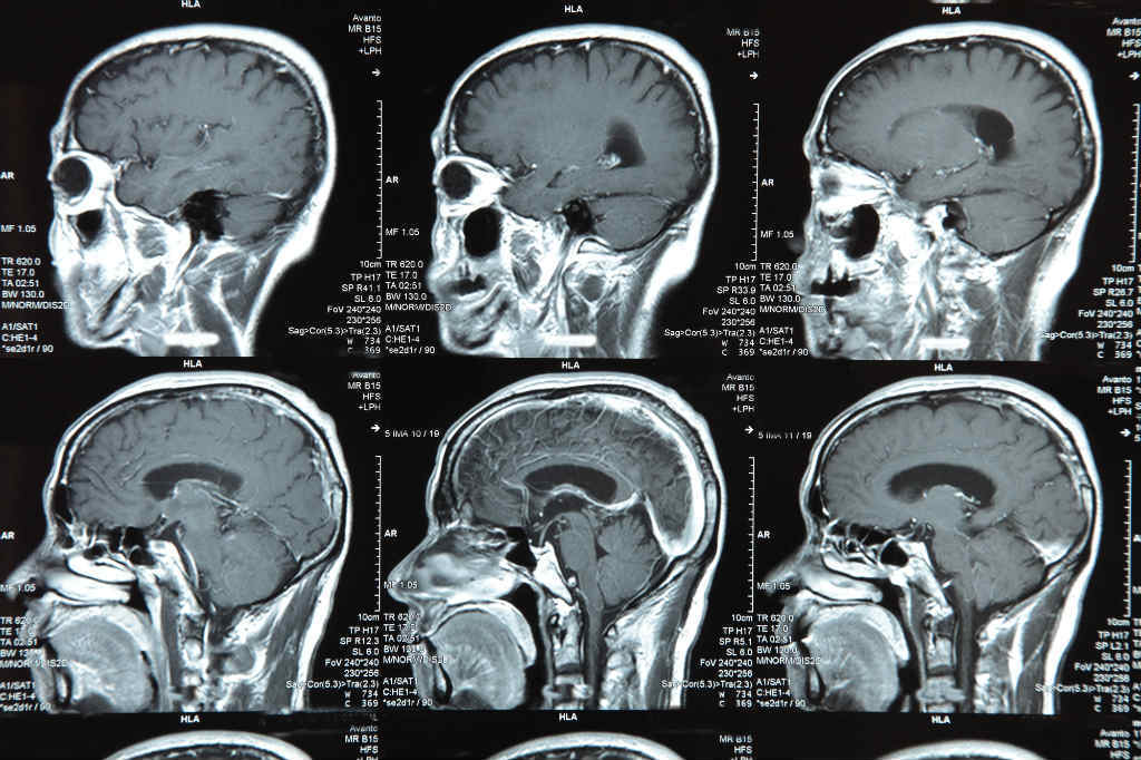 brain-image.jpg