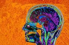 brain2.jpg
