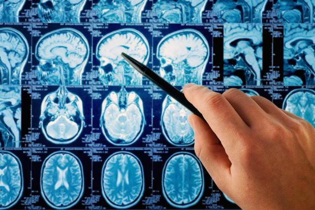 can-cell-phones-cause-brain-cancer-we-asked-the-experts-640x0.jpg