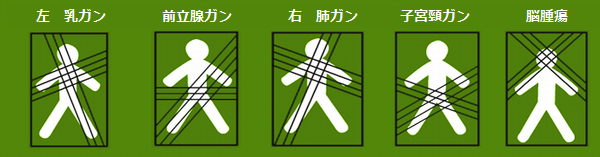 cancer-img2.png
