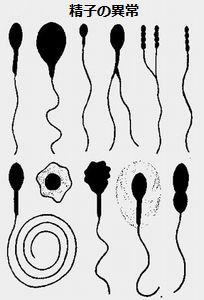 damagedSperm.jpg