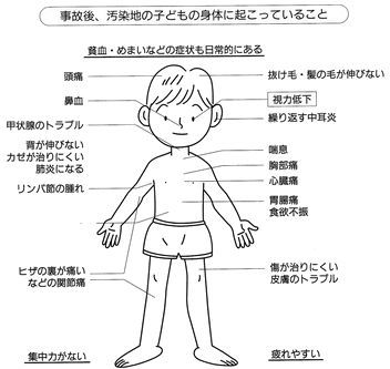 kodomo-hibaku.jpg
