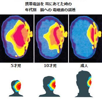 mobileradiationbrain.jpg