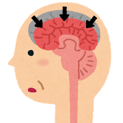 sick_ninchisyou_alzheimer.png