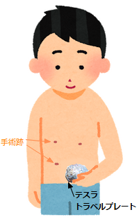 傷口に、テスラ トラベルプレート